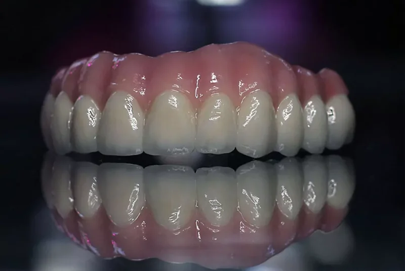 Zirconia Fixed Bridge