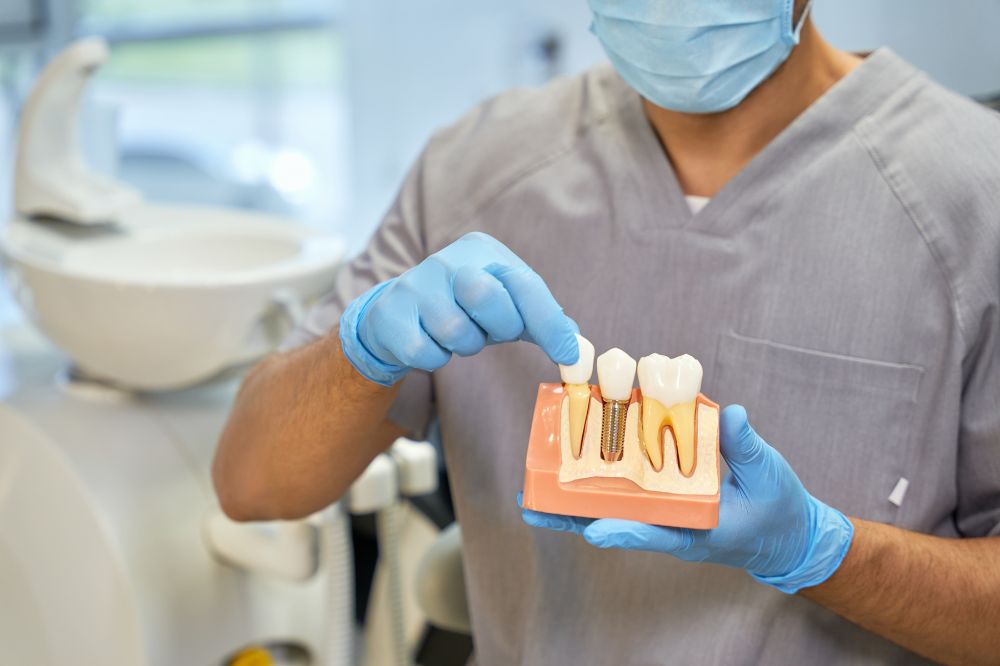 dental implant consultation in Gulfgate Houston, TX