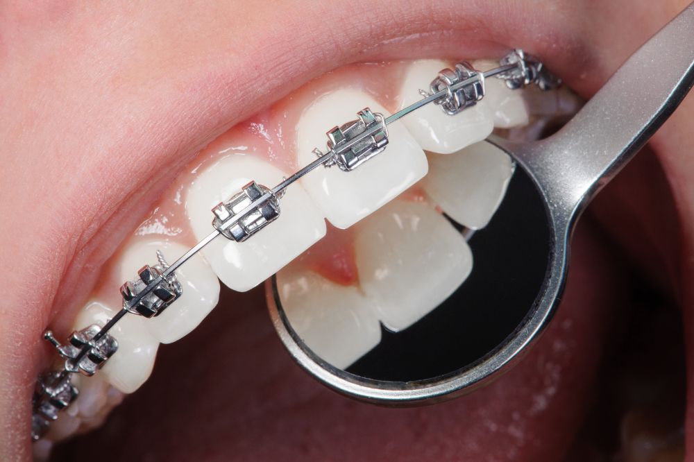 dentists in Gulfgate